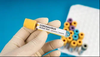 Teste coronavírus