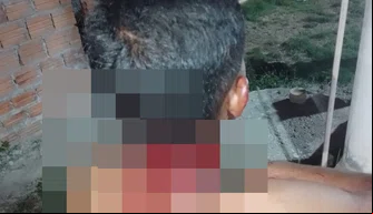Jovem sofre corte profundo no pescoço durante briga com irmão em José de Freitas